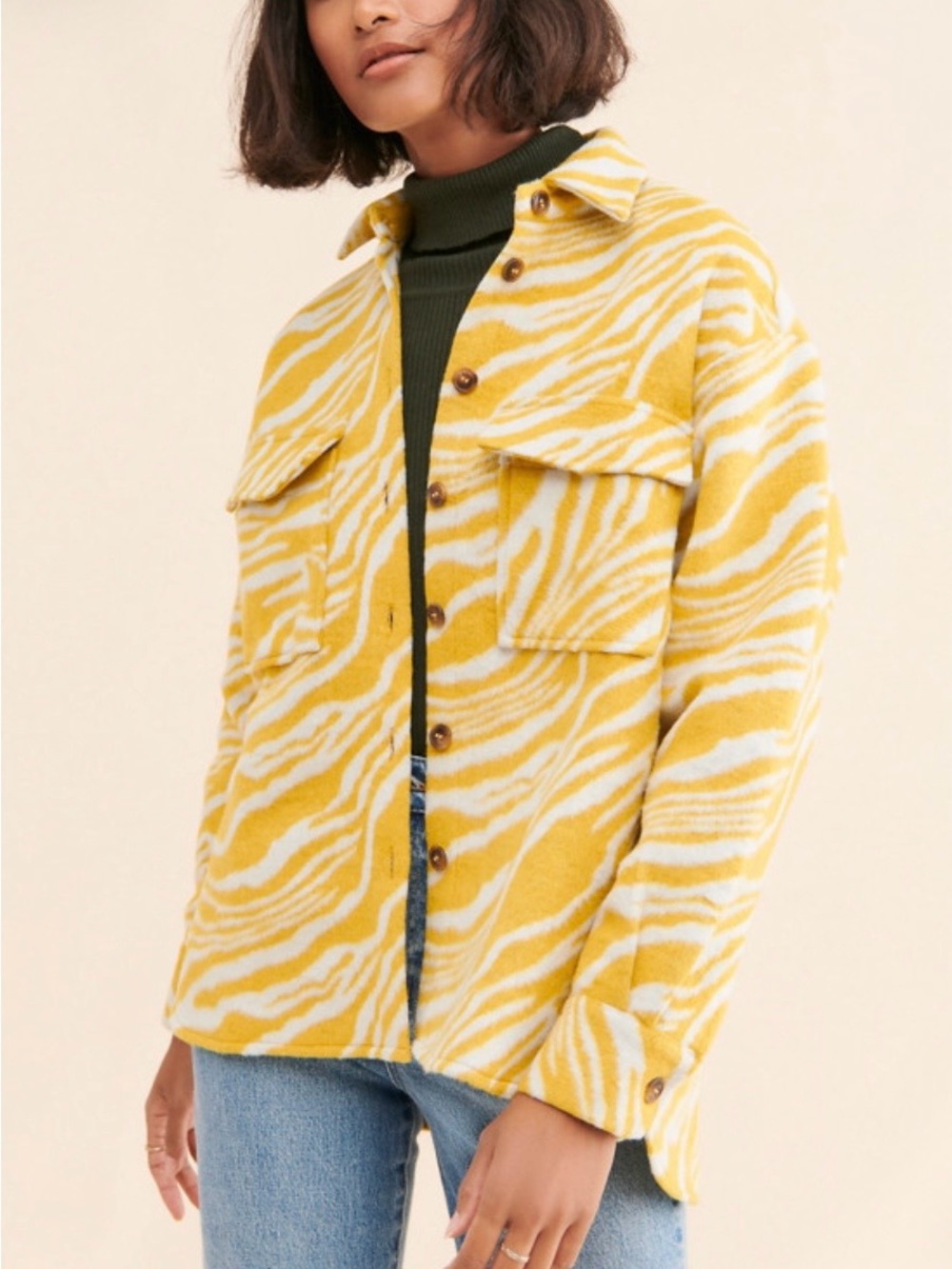 Yellow Zebra-Print Shacket